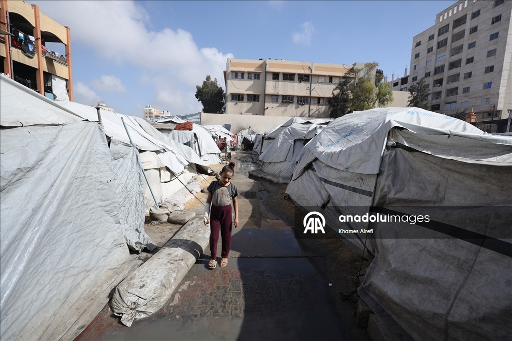 Тяжело раненная в результате израильских атак палестинская девочка испытывает трудности при ходьбе