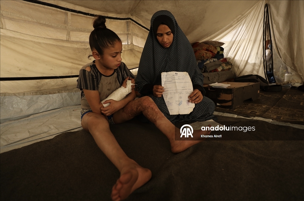 Тяжело раненная в результате израильских атак палестинская девочка испытывает трудности при ходьбе