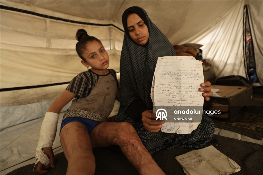 Тяжело раненная в результате израильских атак палестинская девочка испытывает трудности при ходьбе