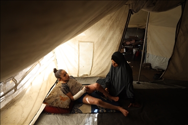 Тяжело раненная в результате израильских атак палестинская девочка испытывает трудности при ходьбе