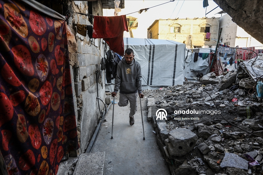 İsrail saldırılarında sağ bacağını kaybeden Filistinli Al-Faqawi, zor şartlar altında yaşam mücadelesi veriyor