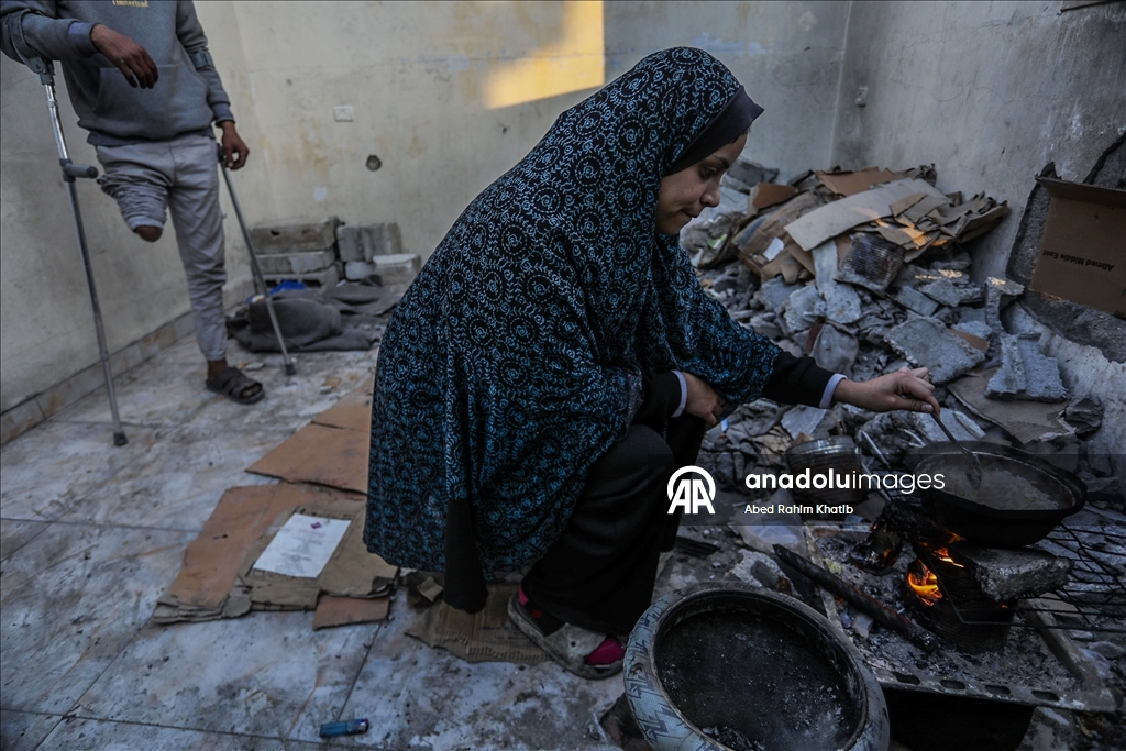 İsrail saldırılarında sağ bacağını kaybeden Filistinli Al-Faqawi, zor şartlar altında yaşam mücadelesi veriyor