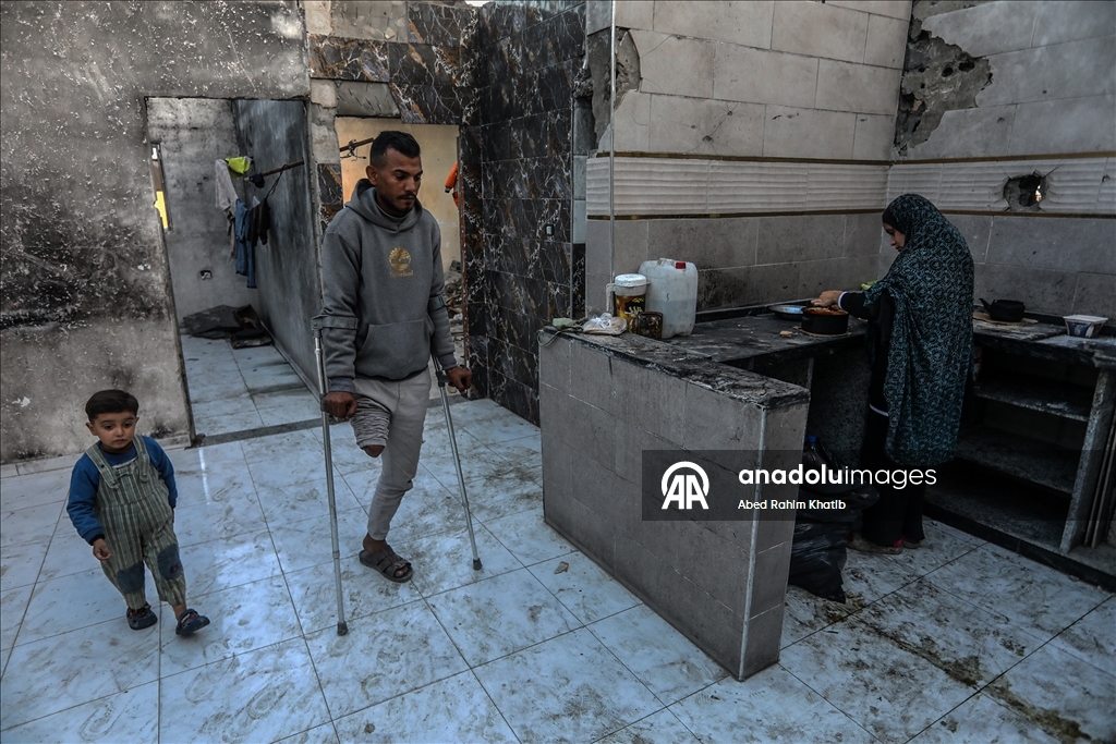 İsrail saldırılarında sağ bacağını kaybeden Filistinli Al-Faqawi, zor şartlar altında yaşam mücadelesi veriyor