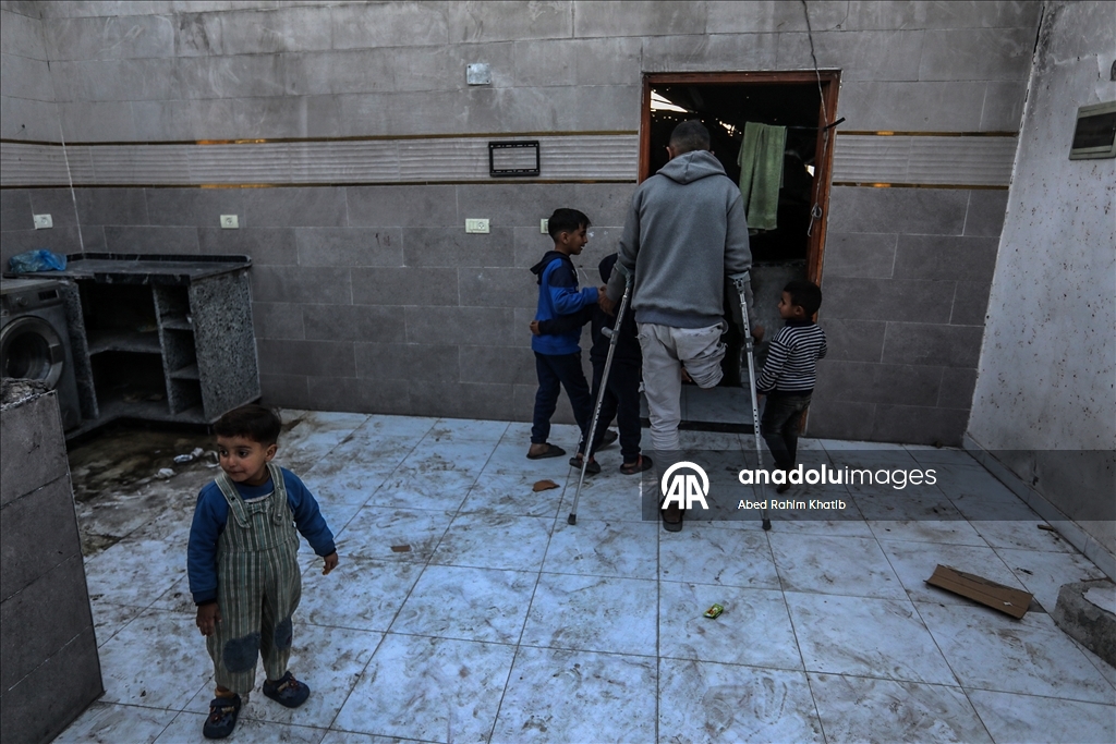 İsrail saldırılarında sağ bacağını kaybeden Filistinli Al-Faqawi, zor şartlar altında yaşam mücadelesi veriyor