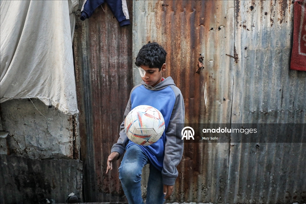 Палестинский ребенок, потерявший один глаз в результате атаки Израиля, мечтает после лечения снова играть в футбол со сверстниками