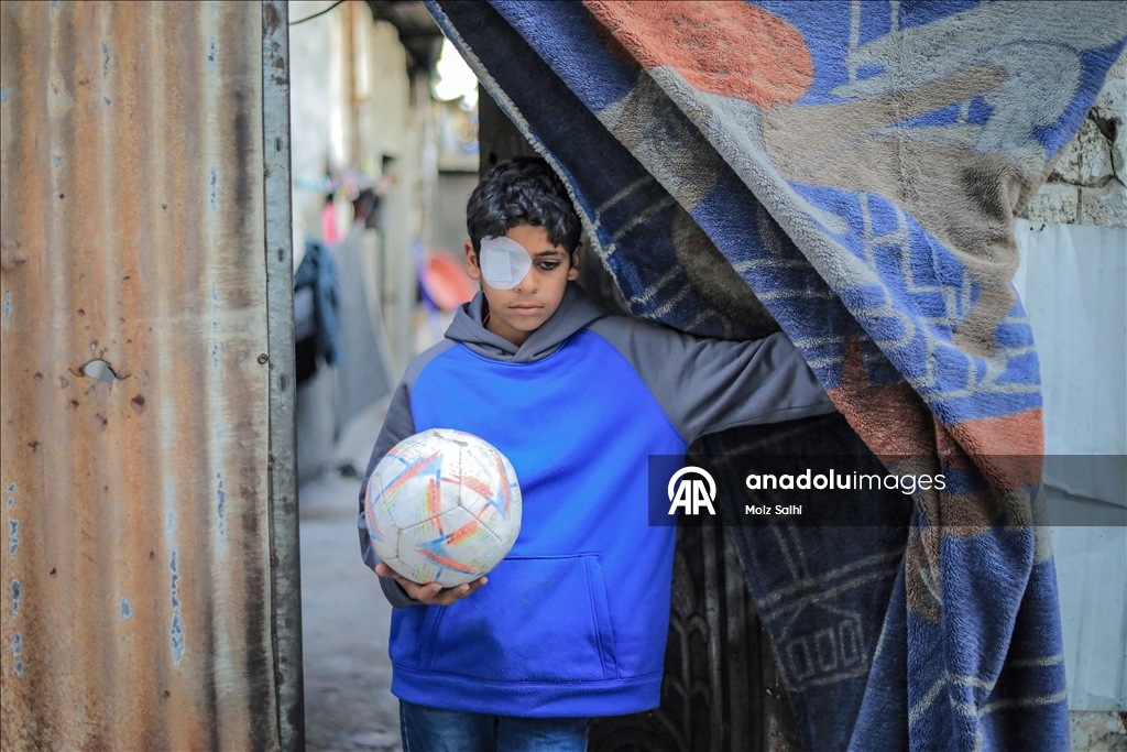 Палестинский ребенок, потерявший один глаз в результате атаки Израиля, мечтает после лечения снова играть в футбол со сверстниками