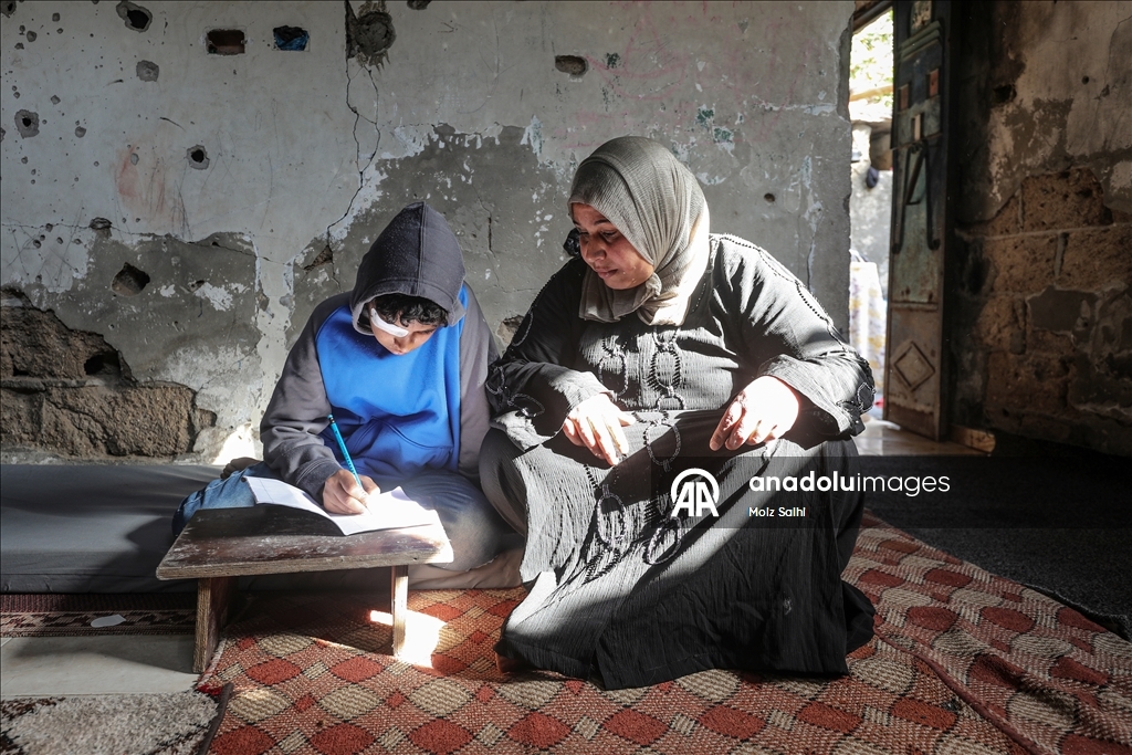 Палестинский ребенок, потерявший один глаз в результате атаки Израиля, мечтает после лечения снова играть в футбол со сверстниками