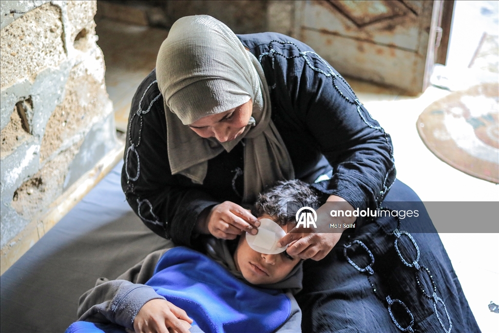 Палестинский ребенок, потерявший один глаз в результате атаки Израиля, мечтает после лечения снова играть в футбол со сверстниками