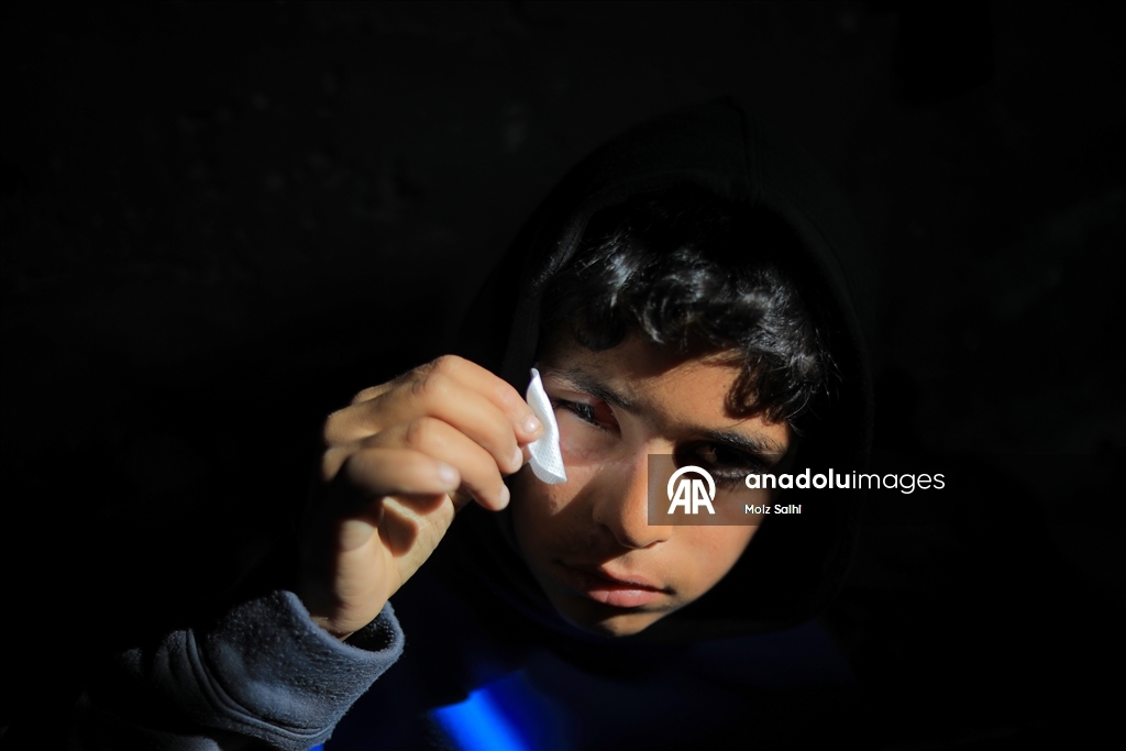 Палестинский ребенок, потерявший один глаз в результате атаки Израиля, мечтает после лечения снова играть в футбол со сверстниками