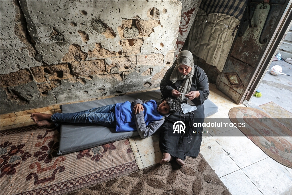 Палестинский ребенок, потерявший один глаз в результате атаки Израиля, мечтает после лечения снова играть в футбол со сверстниками