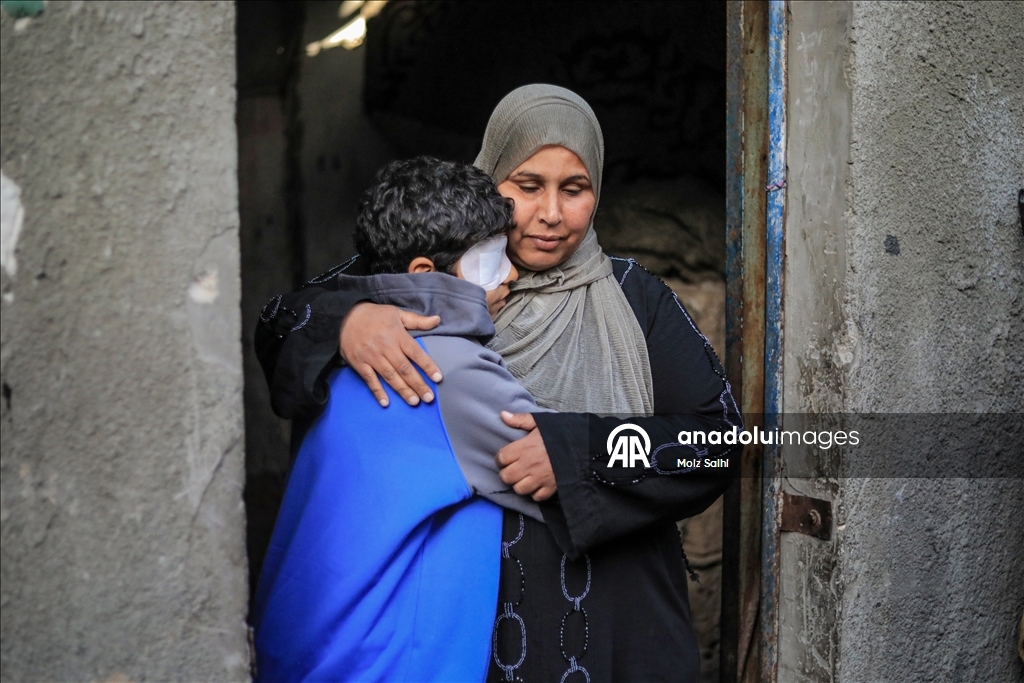 Палестинский ребенок, потерявший один глаз в результате атаки Израиля, мечтает после лечения снова играть в футбол со сверстниками