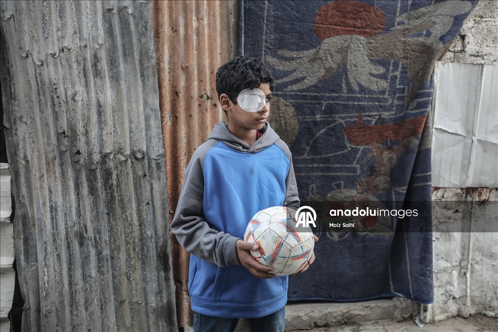 Палестинский ребенок, потерявший один глаз в результате атаки Израиля, мечтает после лечения снова играть в футбол со сверстниками