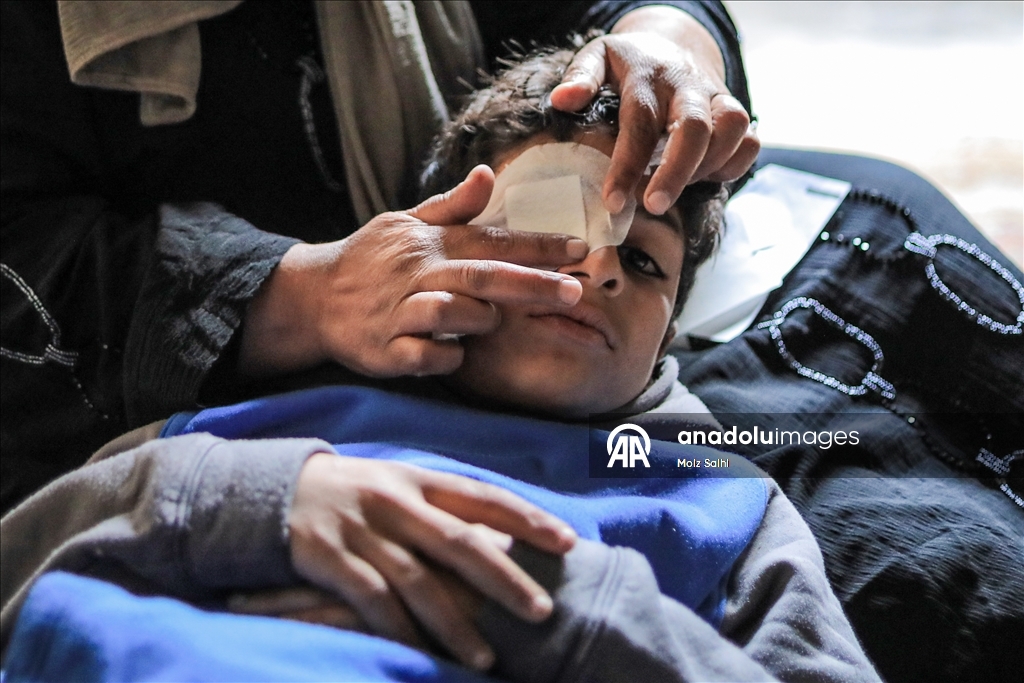 Палестинский ребенок, потерявший один глаз в результате атаки Израиля, мечтает после лечения снова играть в футбол со сверстниками