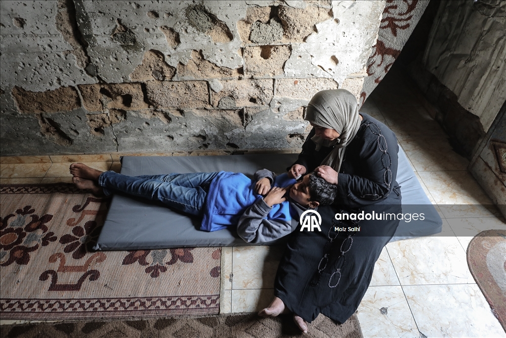 Палестинский ребенок, потерявший один глаз в результате атаки Израиля, мечтает после лечения снова играть в футбол со сверстниками