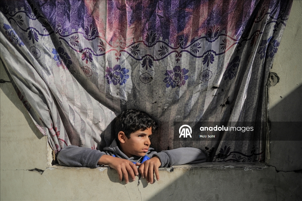 Палестинский ребенок, потерявший один глаз в результате атаки Израиля, мечтает после лечения снова играть в футбол со сверстниками