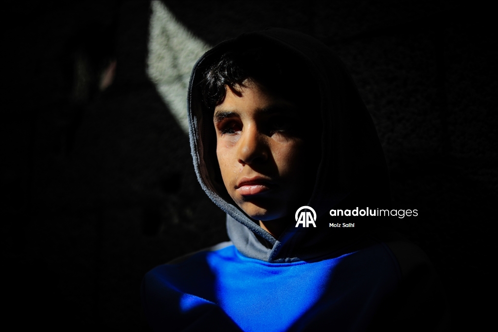 Палестинский ребенок, потерявший один глаз в результате атаки Израиля, мечтает после лечения снова играть в футбол со сверстниками