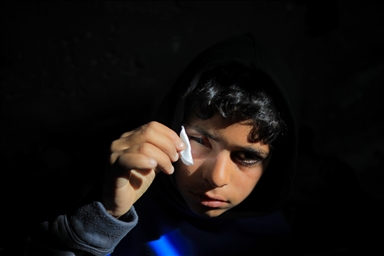 Палестинский ребенок, потерявший один глаз в результате атаки Израиля, мечтает после лечения снова играть в футбол со сверстниками