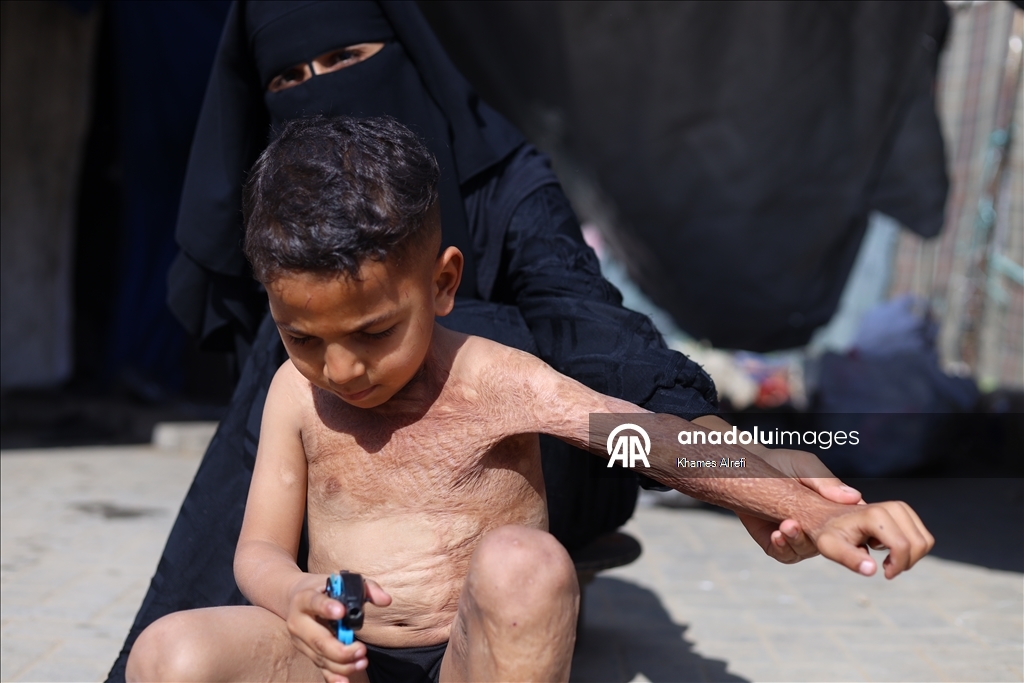 Призыв помочь лечению шестилетнего палестинца Муина