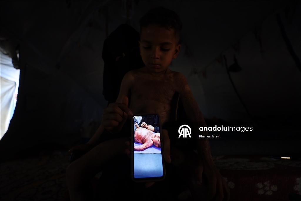 Призыв помочь лечению шестилетнего палестинца Муина