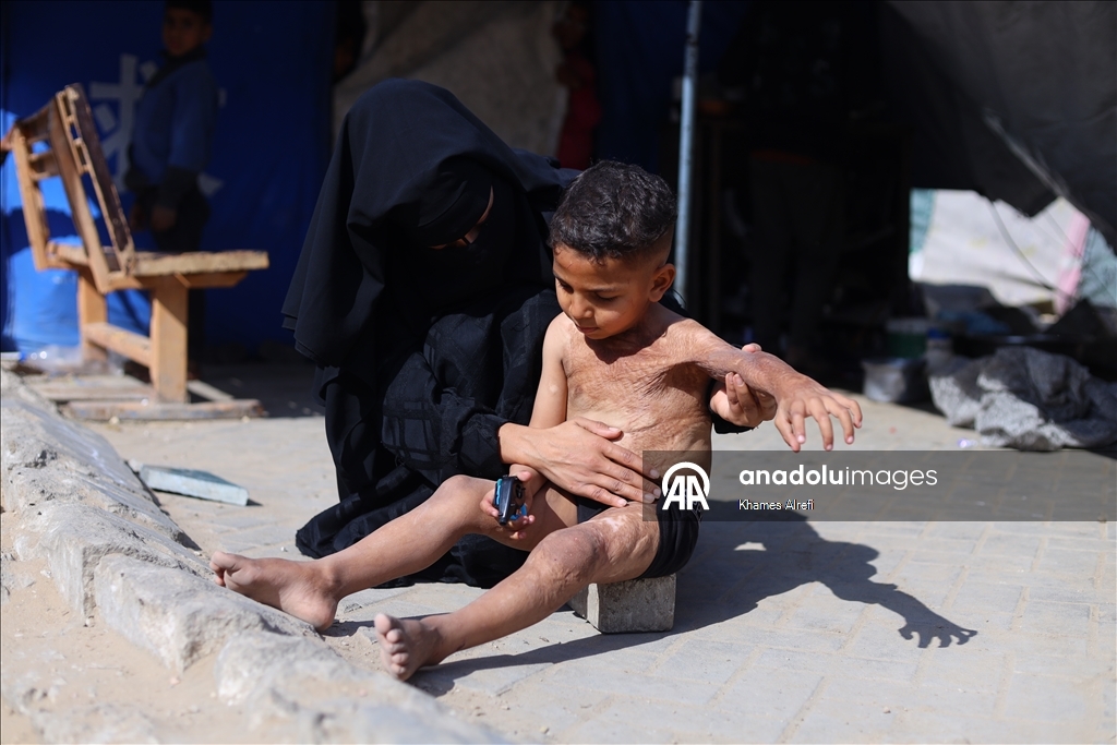 Призыв помочь лечению шестилетнего палестинца Муина