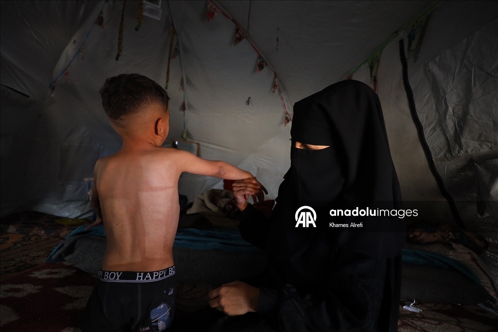 Призыв помочь лечению шестилетнего палестинца Муина