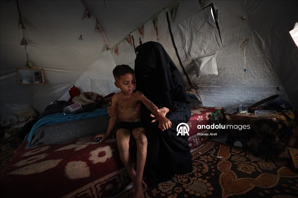 Призыв помочь лечению шестилетнего палестинца Муина