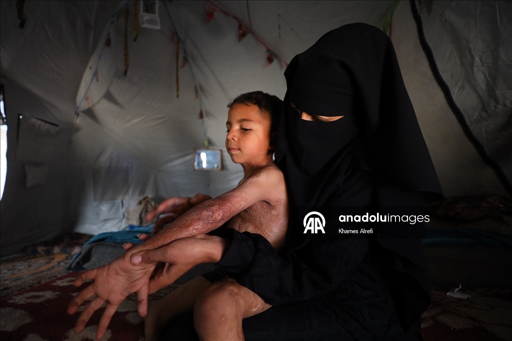 Призыв помочь лечению шестилетнего палестинца Муина