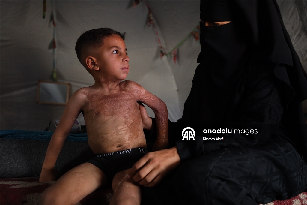 Призыв помочь лечению шестилетнего палестинца Муина