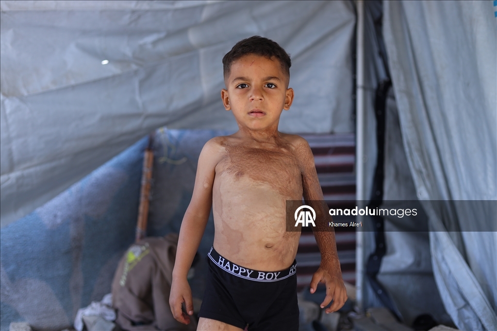 Призыв помочь лечению шестилетнего палестинца Муина