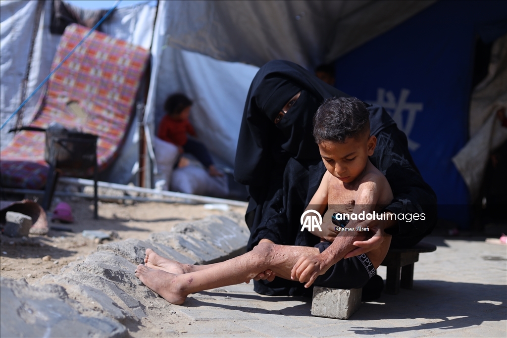 Призыв помочь лечению шестилетнего палестинца Муина