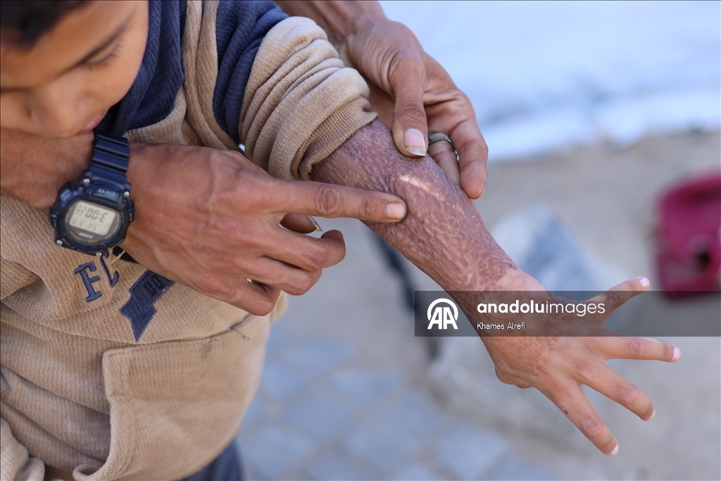 Призыв помочь лечению шестилетнего палестинца Муина