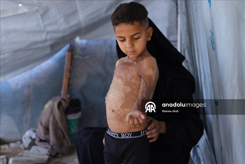 Призыв помочь лечению шестилетнего палестинца Муина