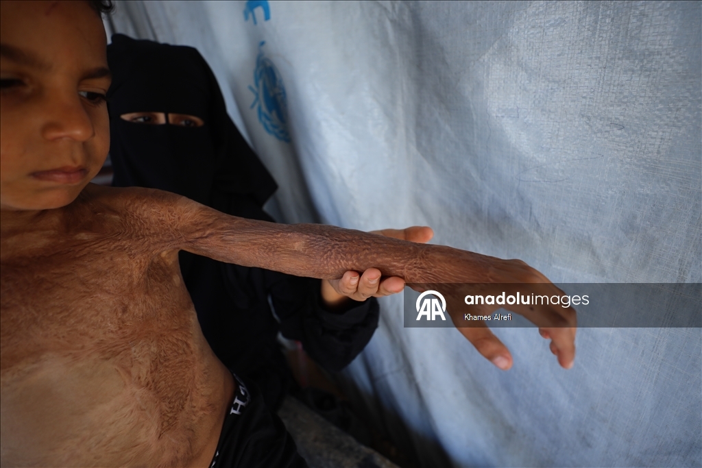 Призыв помочь лечению шестилетнего палестинца Муина