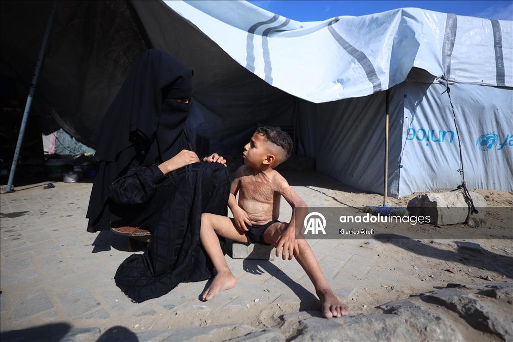 Призыв помочь лечению шестилетнего палестинца Муина