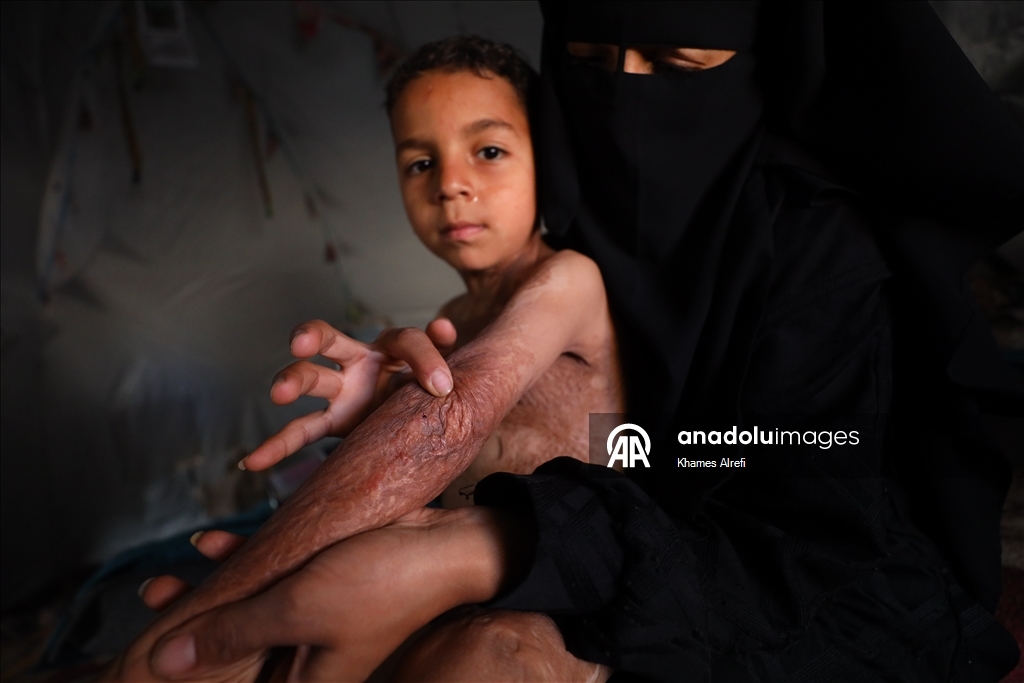 Призыв помочь лечению шестилетнего палестинца Муина