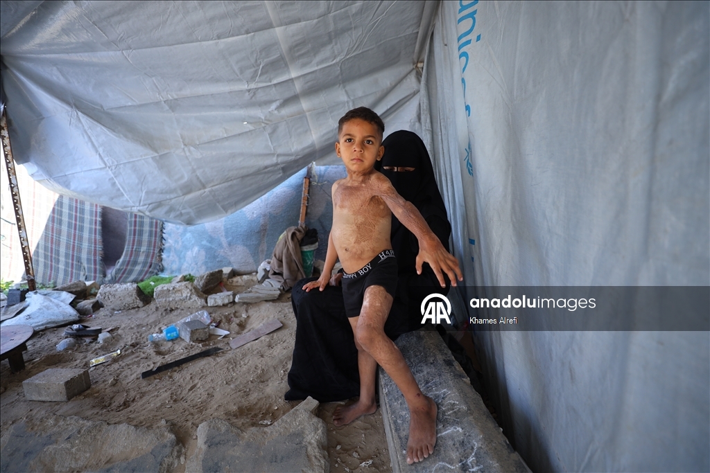 Призыв помочь лечению шестилетнего палестинца Муина