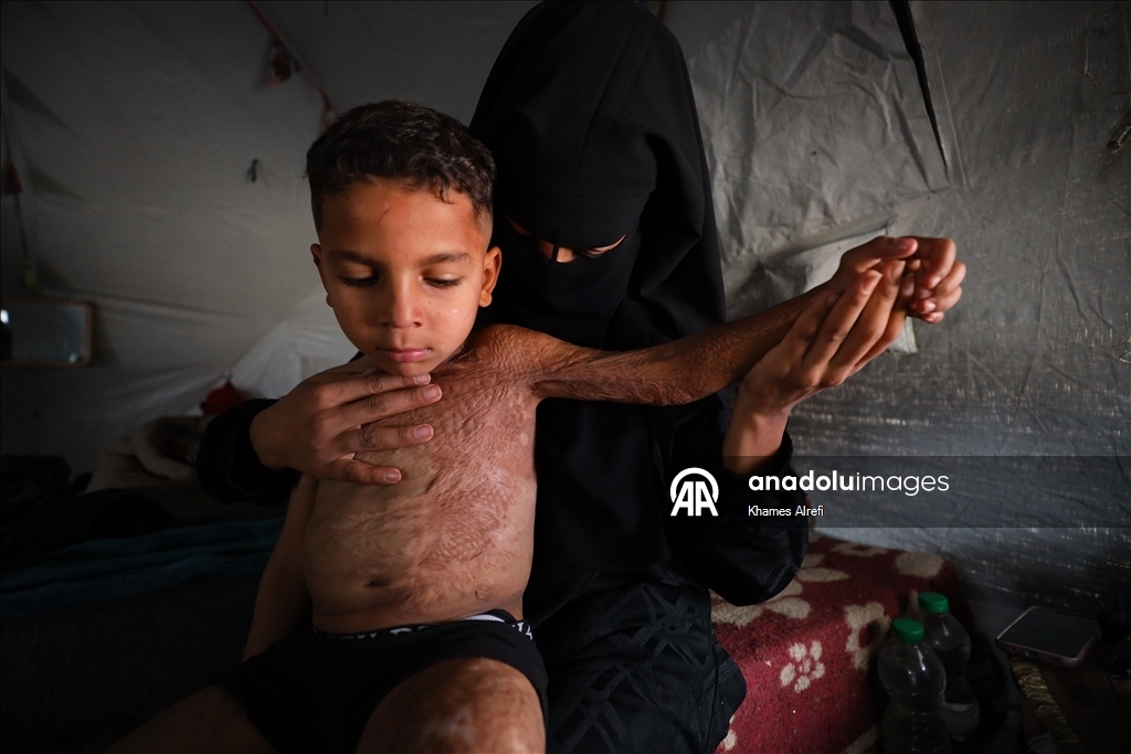 Призыв помочь лечению шестилетнего палестинца Муина