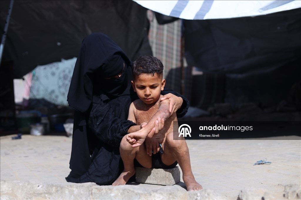 Призыв помочь лечению шестилетнего палестинца Муина