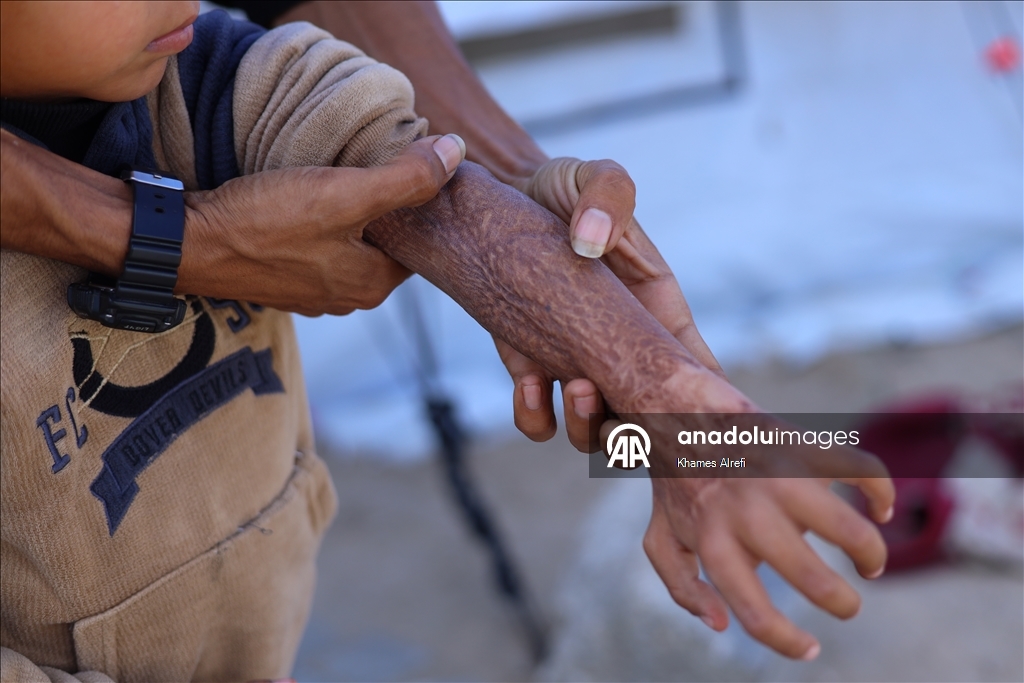 Призыв помочь лечению шестилетнего палестинца Муина