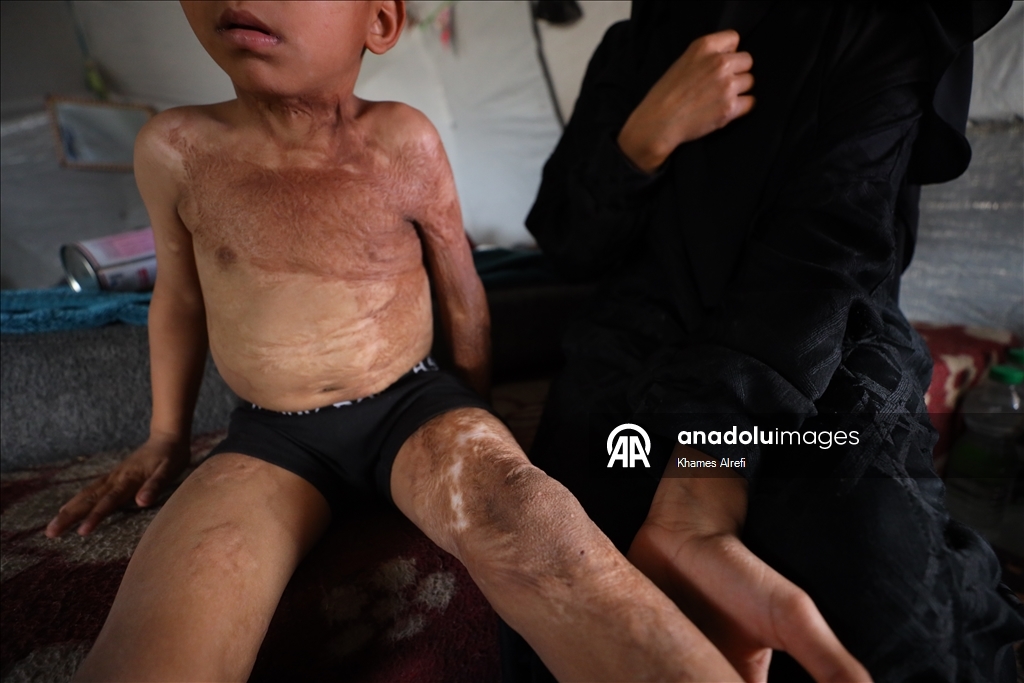 Призыв помочь лечению шестилетнего палестинца Муина