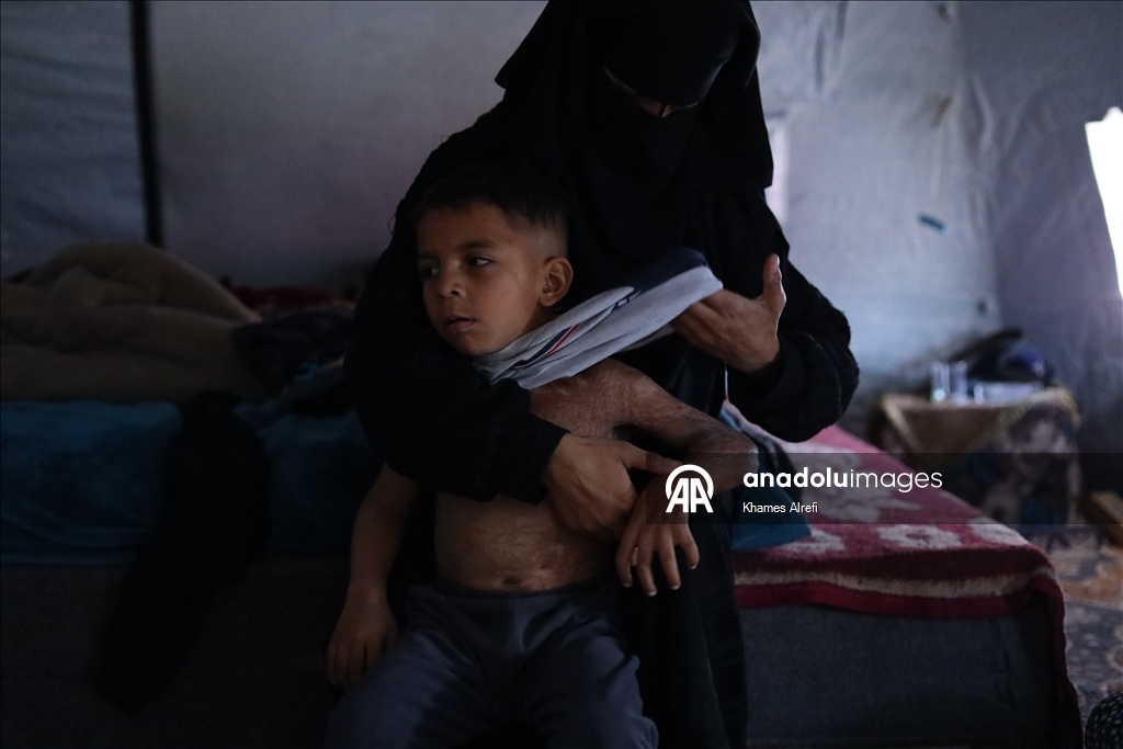 Призыв помочь лечению шестилетнего палестинца Муина