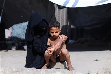 Призыв помочь лечению шестилетнего палестинца Муина