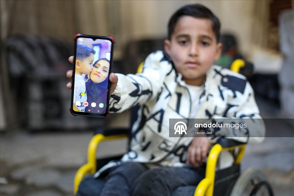 İsrail saldırıları sonucu yaralanan Filistinli çocuk, tekerlekli sandalyeye mahkum kaldı