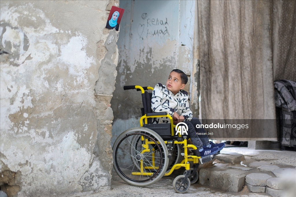 İsrail saldırıları sonucu yaralanan Filistinli çocuk, tekerlekli sandalyeye mahkum kaldı