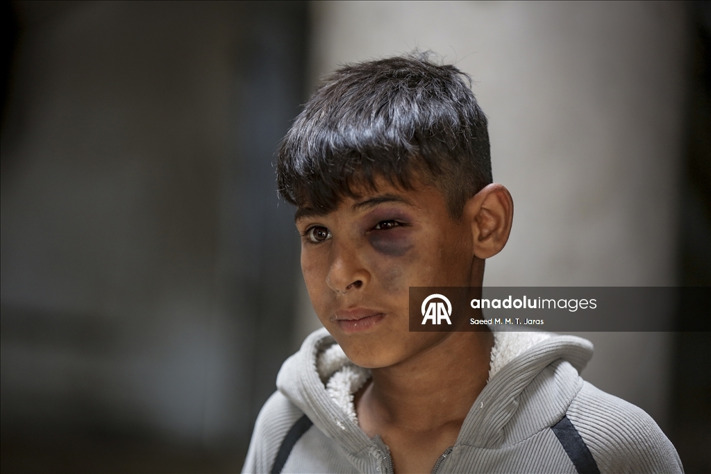 Gazze kentinde yerinden edilen Filistinliler üniversite yerleşkesine sığındı