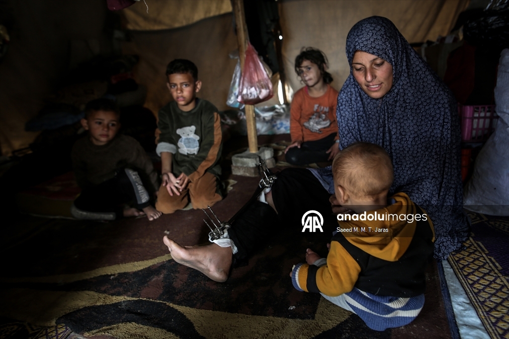 İsrail saldırısında ağır yaralanan Filistinli anne tedavi olmayı bekliyor