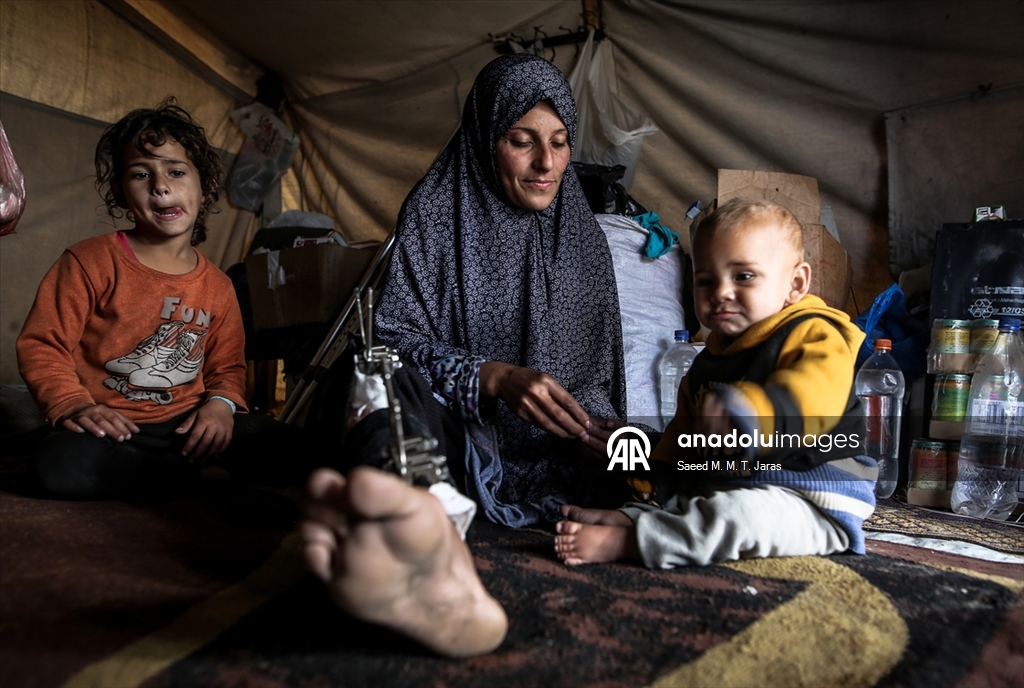 İsrail saldırısında ağır yaralanan Filistinli anne tedavi olmayı bekliyor