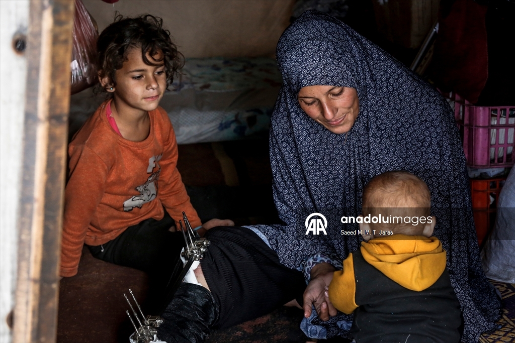 İsrail saldırısında ağır yaralanan Filistinli anne tedavi olmayı bekliyor