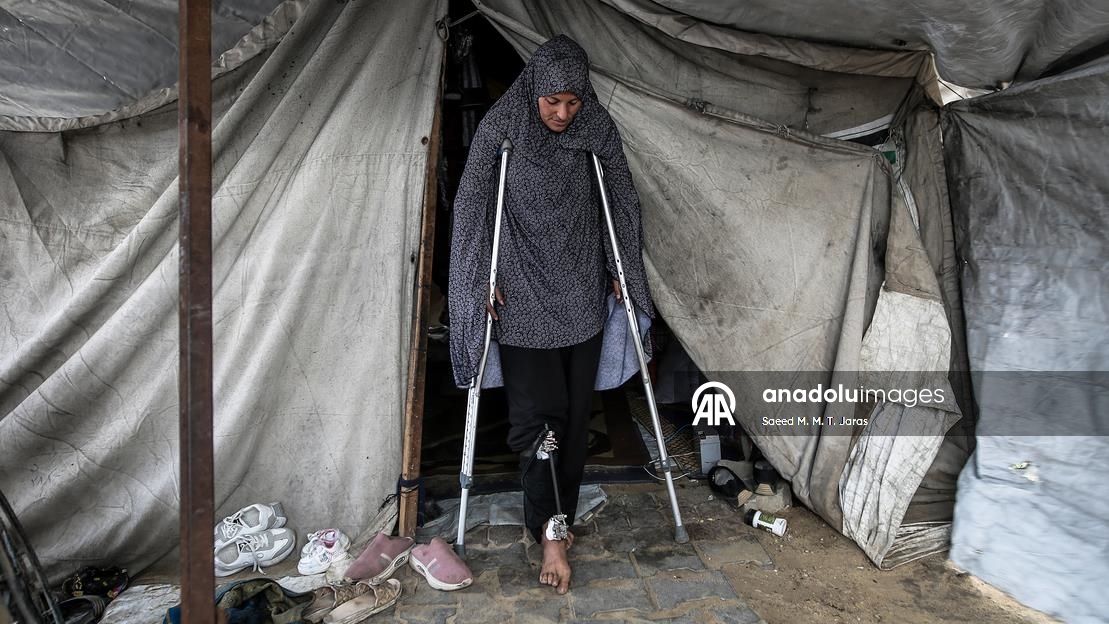 İsrail saldırısında ağır yaralanan Filistinli anne tedavi olmayı bekliyor