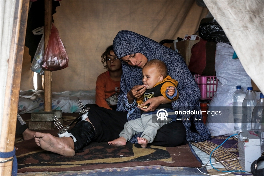 İsrail saldırısında ağır yaralanan Filistinli anne tedavi olmayı bekliyor